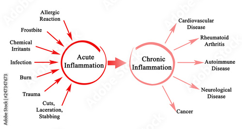 Acute and Chronic Inflammation