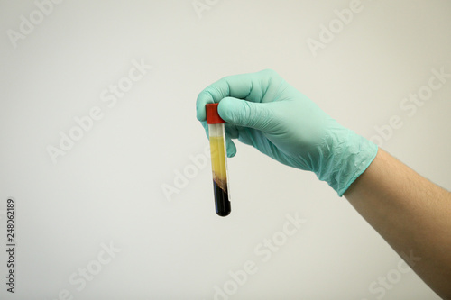 Details with the hand of a doctor holding a vial of blood plasma extracted from blood by centrifugation