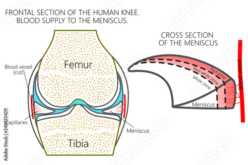 Vector illustration. Frontal section of a healthy human knee, blood supply of the meniscus (red, red-white and white zones). For advertising, medical publications