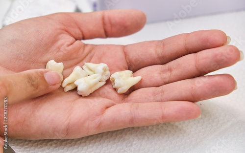 Variety of dentures in dentist hands. Plenty of dentures and dental crowns in doctors palms in protective gloves. Dentist take one dental crown from variety