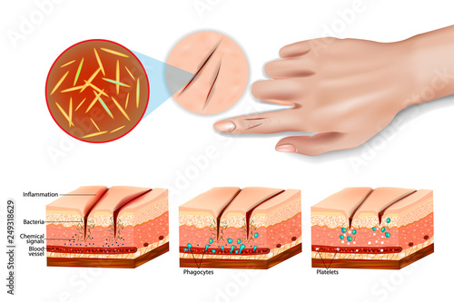 Tissue injury and inflammation. Cell injury inflammation and repair. Immune system