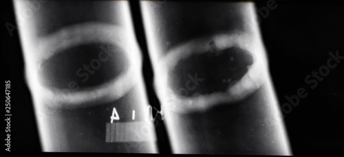 Transcript of x-ray images of welds of pipelines to identify defective areas