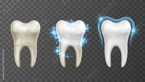 Vector illustration of teeth whitening process - cleaning and protection from stains and bacteria