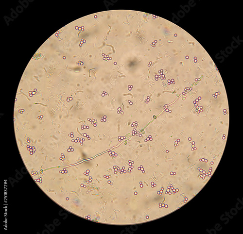 microscopic view of the fungi candida albicans in the native preparation