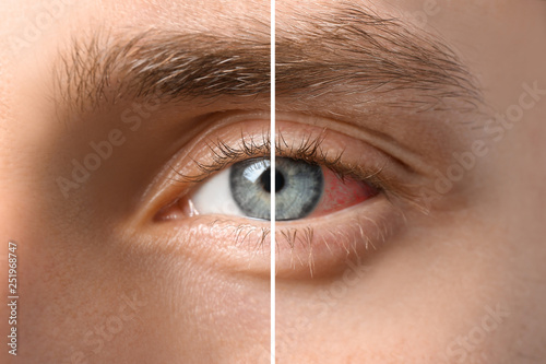 Young man with blue eyes, closeup