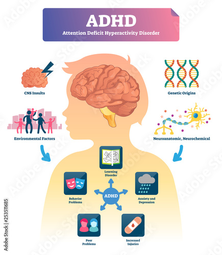 ADHD vector illustration. Labeled mind attention deficit disorder scheme.