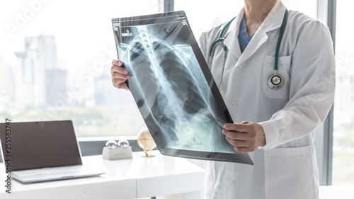 Doctor with radiological chest x-ray film for medical diagnosis on patient’s health on asthma, lung disease and bone cancer illness, healthcare hospital service concept