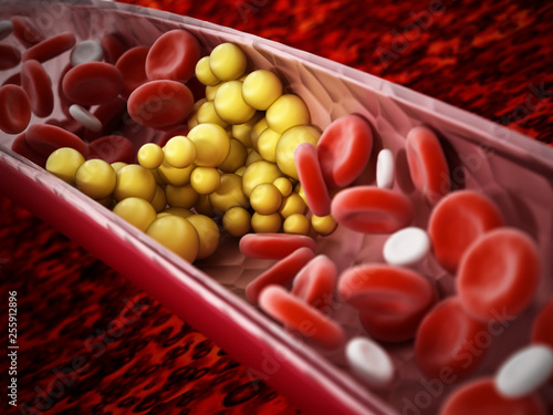 Fat cells blocking the blood flow inside human vein. 3D illustration