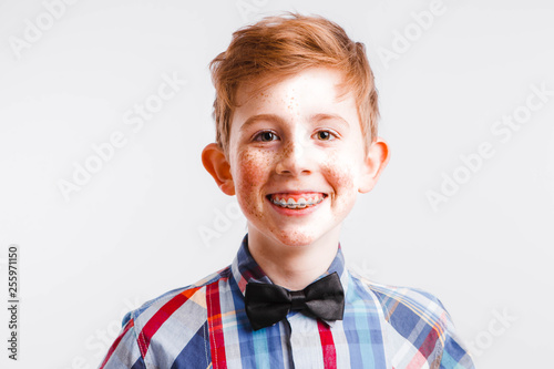 Red-haired nerd with braces and glasses on a white background.