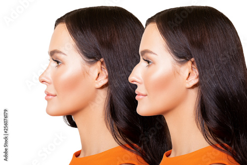 Comparison of Female nose after plastic surgery. portrait of beautiful caucasian young woman in profile is isolated on white background - Image. 