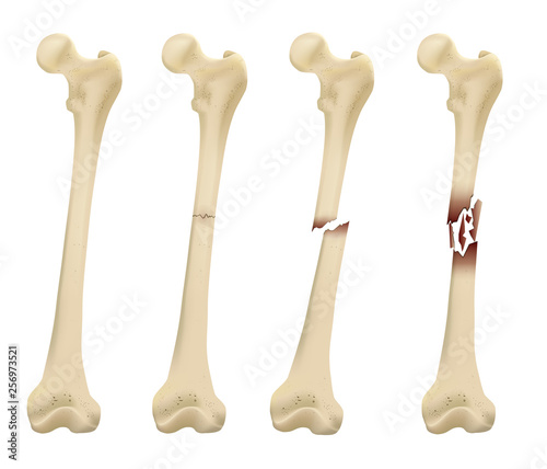 Femur Bone element vector illustration