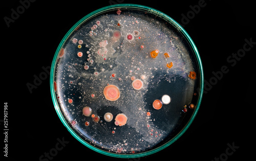 Top view soil microorganisms Nutrient agar in plate on black background.