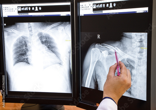 A doctor checking at xray images