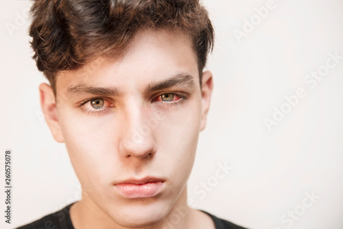 A boy of an adolescent age with a sick red eye on a light background. The boy hurt his eyes because he was ill with conjunctivitis