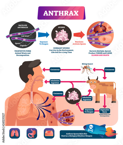Anthrax vector illustration. Labeled medical infection disease cycle scheme