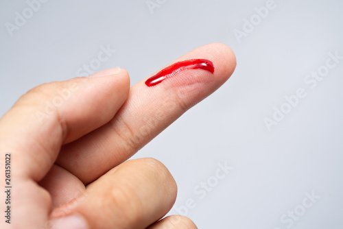 Bleeding blood from the cut finger wound. Injured finger with bleeding open cut wound. Closeup of finger human hand is cut hurt bleeding with bright red blood. 