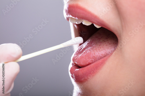 Dentist's Hand Taking Saliva Test From Woman's Mouth