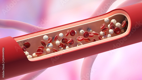 Red and white blood cells in the vein. Leukocyte high level