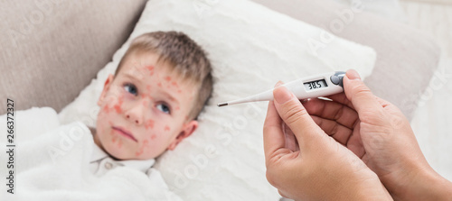 High Fever Measles Virus. Mother Measuring Temperature Of Son