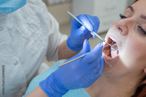 Woman dentist checking her patient for caries. Red-haired woman examined by a doctor. The girl will do the health of the teeth. Close-up.