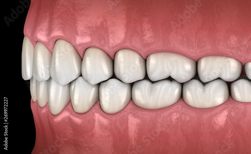 Healthy human teeth with normal occlusion, side view. Medically accurate tooth 3D illustration