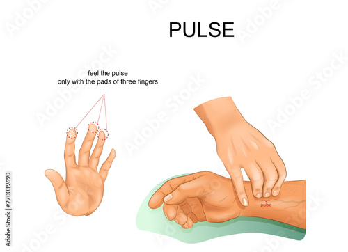 correct pulse palpation
