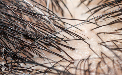 Macro photography of gray hair and black hair on Scalp.