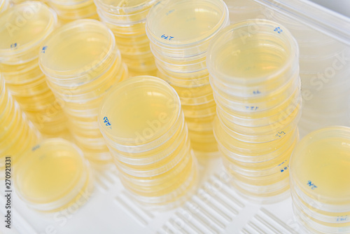 Stack of petri dishes with cultures in agar algae.