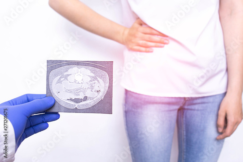 The doctor holds in his hand a snapshot of magnetic resonance imaging against the background of a patient with an appendicitis, determination and diagnosis of an apeditsita using computed tomography