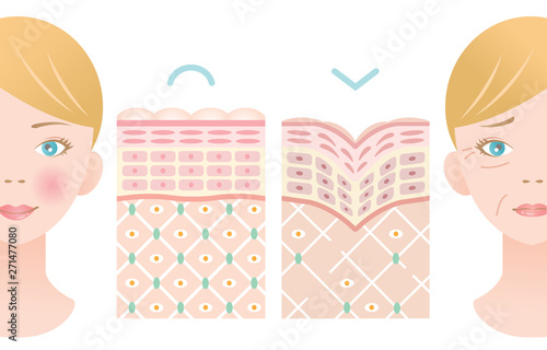 健康肌 しわ肌 肌の構造と白人女性