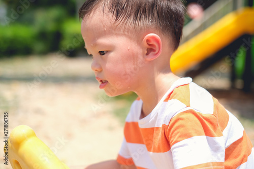 Cute little Asian 2 - 3 years old toddler baby boy child sweating during having fun playing, exercising outdoor at playground on nature at park, Heat stroke and summer sunstroke risk symptom concept