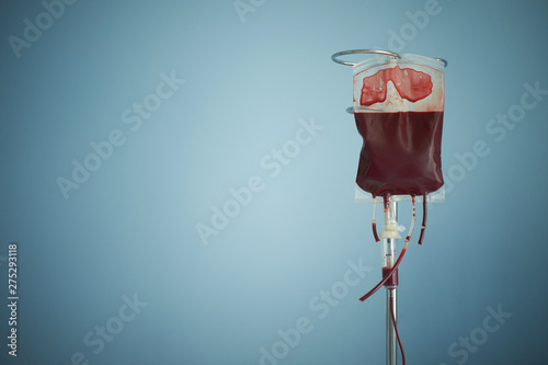 transfusion of blood, bag with red blood cells on stand. Blue background with copy space