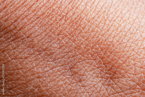 texture of the skin.Dark skin of woman hand macro. Human skin texture background