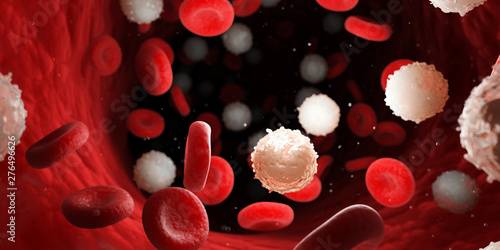 3d rendered medically accurate illustration of too many white blood cells due to leukemia