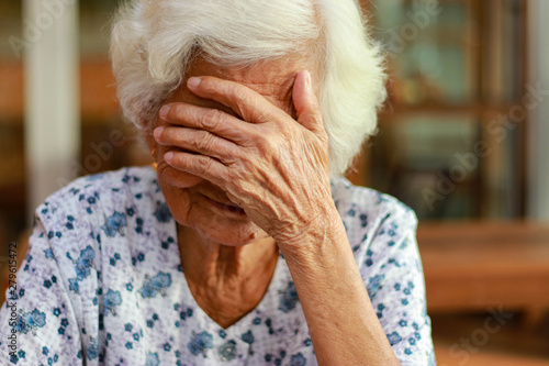 Asian woman with white hair shows signs of memory impairment. Health problems and treatment costs.