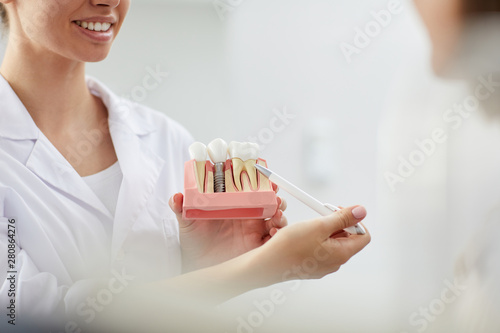 Closeup of smiling female dentist pointing at tooth model while consulting patient in clinic, copy space