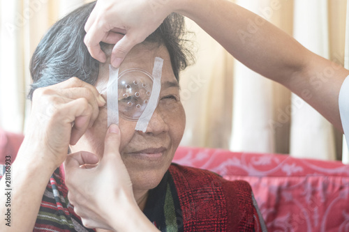 Cataract treatment after surgery by caregiver concept. Asia old woman placed protective shield over her eye taping the cover to protect during naps time.