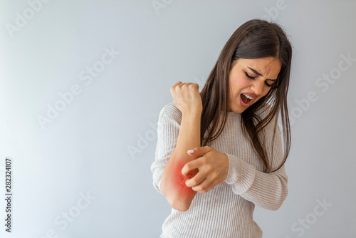 Young woman scratching arm from having itching on white background. Cause of itchy skin include insect bites, dermatitis, food/drugs allergies or dry skin. Health care concept. Close up.