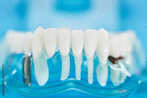 close up of teeth model with dental roots in white teeth on blue