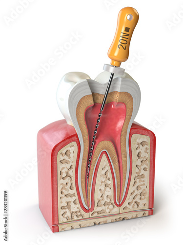 Cross section of Human tooth with endodontic file isolated on white.