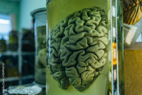 Human brain in glass jar with formaldehyde for medical studies