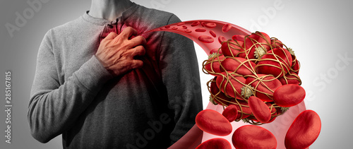 Blood Clot Health Risk