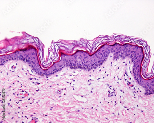 Thin skin. Hematoxylin-eosin