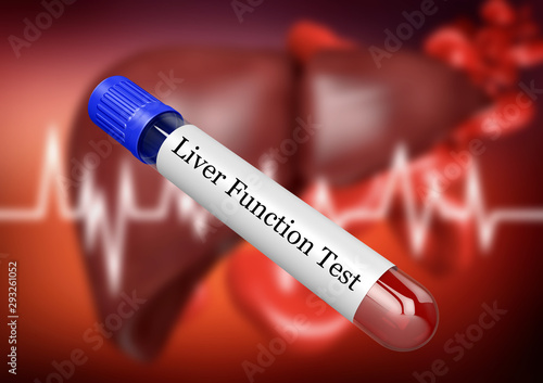 Blood sample in test tube for examination of liver function in laboratory