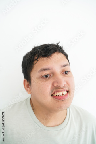 Portrait of smiling disable asian men standing on white background