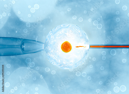 Artificial or assisted fertilization is the process by which the union of gametes is artificially carried out, by observation under a microscope, 3d rendering