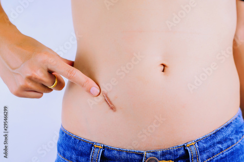 Pointing, Showing appendix scar at abdomen isolated on white background.