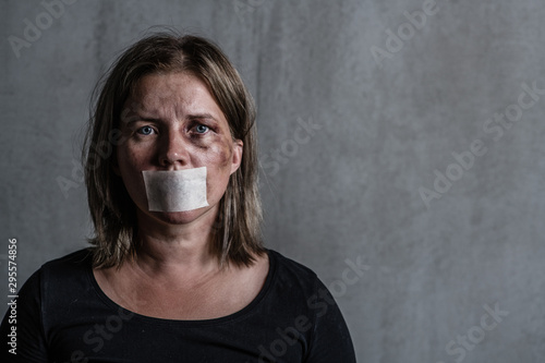 Beaten up woman victim of domestic violence and abusewith covered her mouth