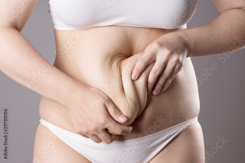 Flabby belly after pregnancy, overweight female body on gray background