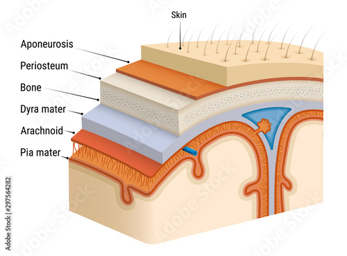 Inflammation of the meninges - meningitis. Bacterial inflammation of the soft membrane of the human brain. Layout. Isolated on a white background. Vector.